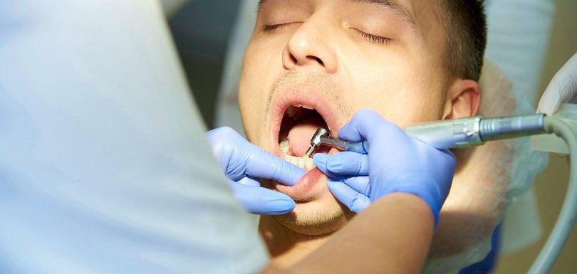 Diş Dolgu Fiyatları