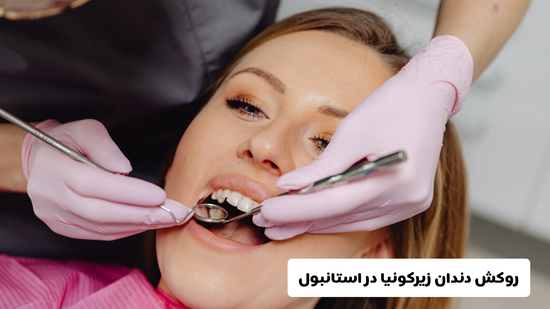 روکش دندان زیرکونیا در استانبول