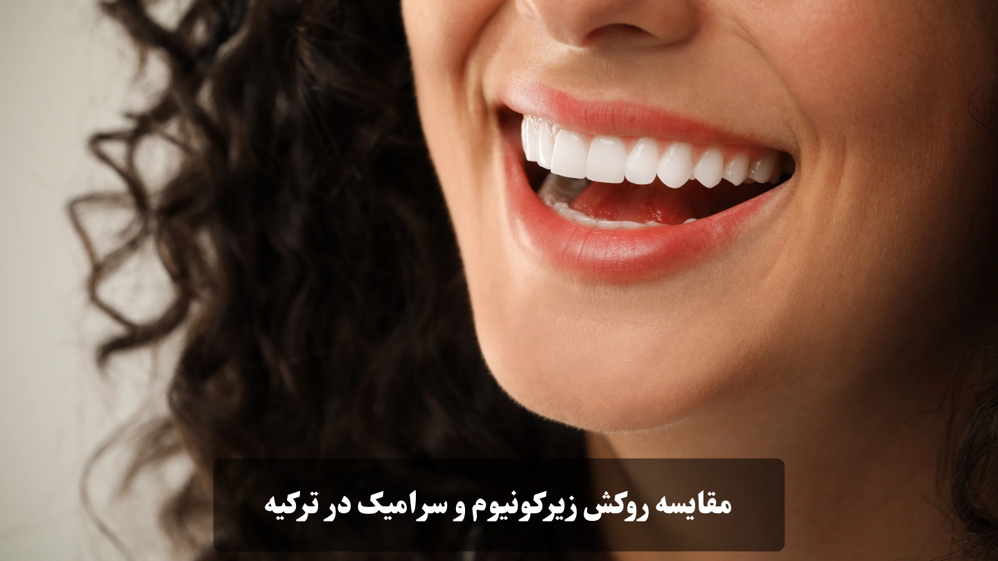 مقایسه روکش زیرکونیوم و سرامیک در ترکیه