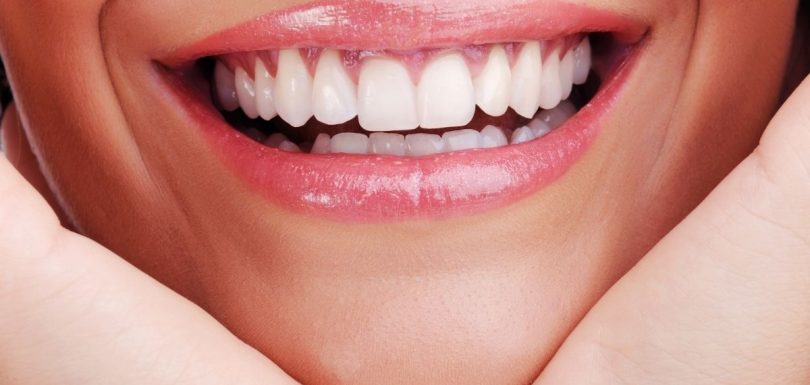 Dental Crowns Cost in Turkey 2026