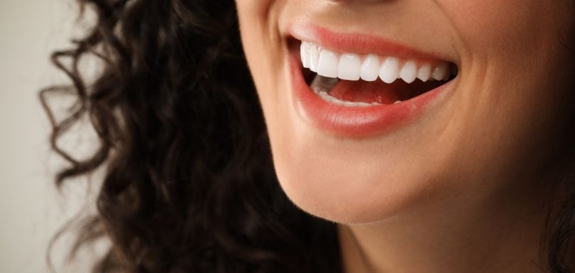 Hollywood Smile ile hayalinizdeki kusursuz gülüşe kavuşun