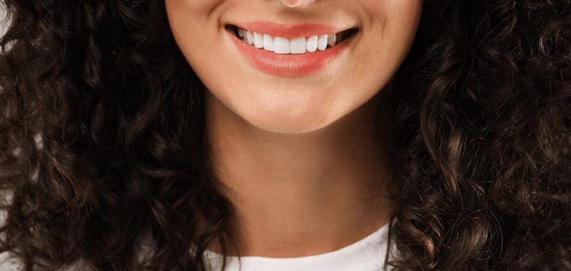 Lamine-Dis-Fiyatlari-2026